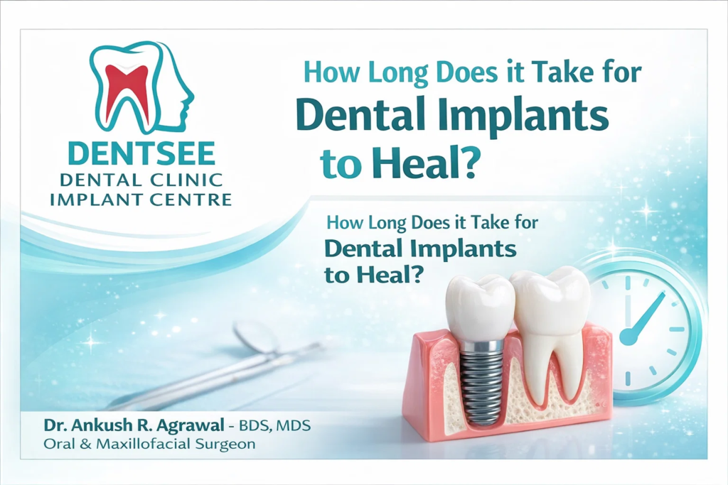 How Long Does it Take for Dental Implants to Heal1